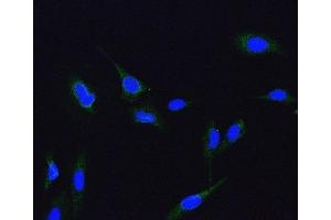 IF analysis of ME2 using anti-ME2 antibody (ABIN7600967).