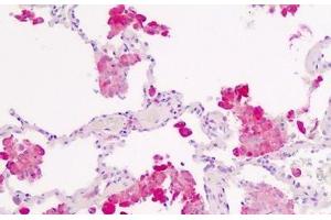Human Lung, Macrophages: Formalin-Fixed, Paraffin-Embedded (FFPE) (IL1R1 抗体  (AA 474-503))
