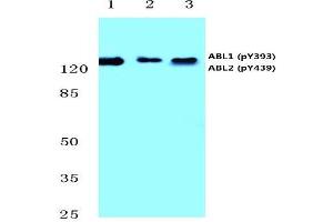 Western blot analysis of p-Abl1/2 antibody (pTyr393/439) Cat. (ABL1 抗体  (pTyr393, pTyr439))
