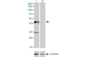 Western Blotting (WB) image for anti-Sphingomyelin Synthase 2 (SGMS2) (AA 2-80) antibody (ABIN566908)