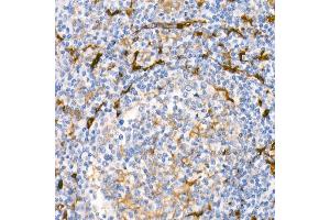 Immunohistochemistry of paraffin-embedded Human tonsil using Fascin/FSCN1 antibody (ABIN7267142) at dilution of 1:100 (40x lens). (Fascin 抗体)
