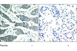 Image no. 1 for anti-V-Akt Murine Thymoma Viral Oncogene Homolog 1 (AKT1) (Tyr312), (Tyr315), (Tyr316) antibody (ABIN319374) (AKT1 抗体  (Tyr312, Tyr315, Tyr316))