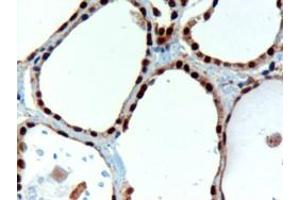 Immunohistochemistry (IHC) image for anti-Paired Box 8 (PAX8) (N-Term) antibody (ABIN184783)