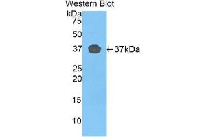 Detection of recombinant FBLN4 using Polyclonal Antibody to Fibulin 4 (FBLN4) (FBLN4 抗体  (AA 278-366))