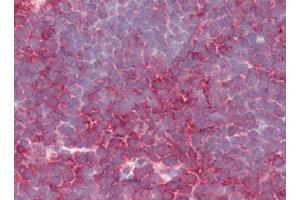 Human Thymus (formalin-fixed, paraffin-embedded) stained with PSENENat 5 µg/ml followed by biotinylated goat anti-rabbit IgG secondary antibody, alkaline phosphatase-streptavidin and chromogen. (PEN2 抗体  (N-Term))