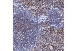 IHC analysis of TRMT61A using anti-TRMT61A antibody (ABIN7599220).