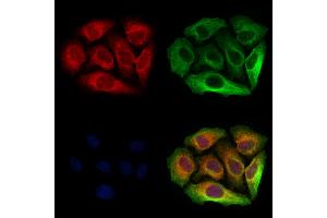 ABIN6263515 and ABIN6273059 staining Hela cells by IF/ICC. (NAPRT1 抗体  (Internal Region))