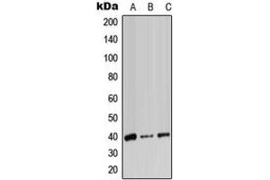 Western blot analysis of ADH7 expression in HeLa (A), SP2/0 (B), PC12 (C) whole cell lysates. (ADH7 抗体  (Center))