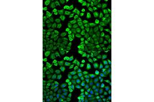 Immunofluorescence analysis of U2OS cell using HNMT antibody. (HNMT 抗体  (AA 1-292))