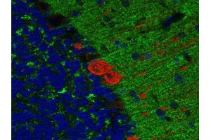 Indirect immunostaining of paraffin embedded mouse cerebellum section with anti-SV2B (dilution 1 : 200; green) and mouse anti-calbindin (cat. (SV2B 抗体  (AA 2-17))