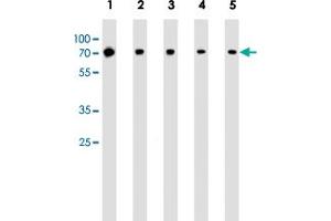 Western blot analysis of Lane 1: Jurkat whole cell lysates Lane 2: MCF-7 whole cell lysates Lane 3: K562 whole cell lysates Lane 4: A549 whole cell lysates Lane 5: mouse NIH/3T3 cell line lysates reacted with RPS6KB2 monoclonal antibody  at 1:1000 dilution. (RPS6KB2 抗体)