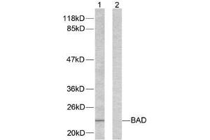 Western blot analysis of extracts from 293 cells using BAD (Ab-155) antibody (E021064). (BAD 抗体)
