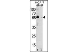 Western blot analysis of SQSTM1 Antibody  pre-incubated without (Lane 1) and with (Lane 2) blocking peptide in MCF-7 cell line lysate. (SQSTM1 抗体  (C-Term))