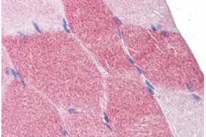 Human Skeletal Muscle: Formalin-Fixed, Paraffin-Embedded (FFPE) (EIF4G2 抗体  (AA 1-204))