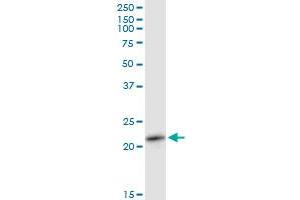 RAB11A MaxPab polyclonal antibody. (RAB11A 抗体  (AA 1-216))