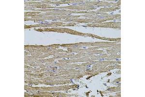 Immunohistochemistry of paraffin-embedded rat heart using HMMR antibody (ABIN5971368) at dilution of 1/100 (40x lens). (HMMR 抗体)