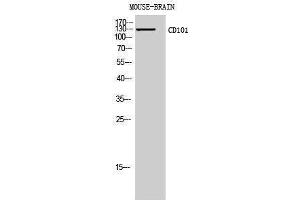 Western Blotting (WB) image for anti-CD101 (CD101) (Internal Region) antibody (ABIN3178946) (CD101 抗体  (Internal Region))