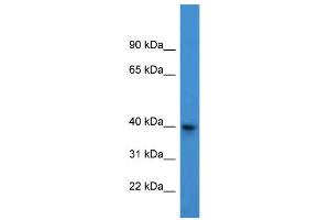 WB Suggested Anti-ARPM1 Antibody Titration: 0. (ARPM1 抗体  (N-Term))
