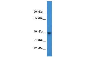 WB Suggested Anti-ARPM1 Antibody Titration: 0. (ARPM1 抗体  (N-Term))