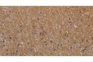 Immunohistochemistry of paraffin-embedded Human brain tissue using NAA25 Polyclonal Antibody at dilution 1:40 (NAA25 抗体)