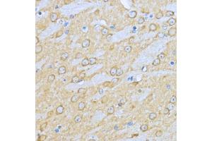 Immunohistochemistry of paraffin-embedded mouse brain using HSP90 antibody (ABIN6134707, ABIN6142027, ABIN6142029 and ABIN6216078) at dilution of 1:200 (40x lens). (HSP90AA1 抗体)