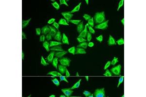 Immunofluorescence analysis of U2OS cells using PGM1 Polyclonal Antibody (Phosphoglucomutase 1 抗体)