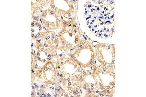 Immunohistochemical analysis of paraffin-embedded H. (UBE2L3 抗体  (C-Term))