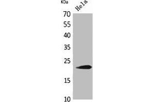 Western Blot analysis of HeLa cells using IFN- Polyclonal Antibody. (IFNW1 抗体  (C-Term))