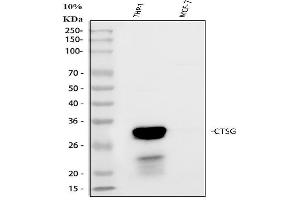 Western blot analysis of Cathepsin G/CTSG using anti-Cathepsin G/CTSG antibody (ABIN4886550).