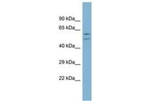 Image no. 1 for anti-ATPase, H+ Transporting, Lysosomal 56/58kDa, V1 Subunit B1 (ATP6V1B1) (AA 395-444) antibody (ABIN6744044)