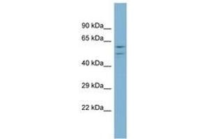 Image no. 1 for anti-ATPase, H+ Transporting, Lysosomal 56/58kDa, V1 Subunit B1 (ATP6V1B1) (AA 395-444) antibody (ABIN6744044) (ATP6V1B1 抗体  (AA 395-444))