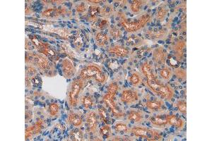 IHC-P analysis of kidney tissue, with DAB staining. (Lactate Dehydrogenase A 抗体  (AA 1-332))