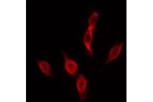 ABIN6276046 staining MCF7 by IF/ICC. (MC4R 抗体  (C-Term))