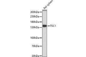 Western blot analysis of extracts of Rat spleen, using TSC1 antibody (ABIN6133755, ABIN6149609, ABIN6149610 and ABIN6213968) at 1:1000 dilution. (TSC1 抗体  (AA 550-650))