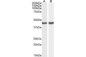Western Blotting (WB) image for anti-Actin, alpha 2, Smooth Muscle, Aorta (ACTA2) (N-Term) antibody (ABIN185271)