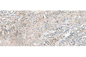 Immunohistochemistry of paraffin-embedded Human tonsil tissue using CTRB1 Polyclonal Antibody at dilution of 1:55(x200) (CTRB1 抗体)
