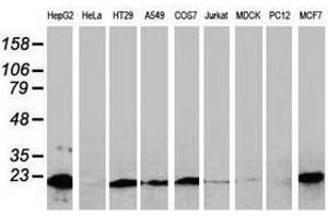 Image no. 2 for anti-NADH Dehydrogenase (Ubiquinone) 1 beta Subcomplex, 9, 22kDa (NDUFB9) (AA 3-179) antibody (ABIN1491362) (NDUFB9 抗体  (AA 3-179))