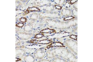 Immunohistochemistry of paraffin-embedded rat kidney using BCAP29 antibody (ABIN5973749) at dilution of 1/100 (40x lens). (BCAP29 抗体)