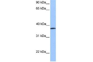 WB Suggested Anti-UBA5 Antibody Titration:  0. (UBA5 抗体  (Middle Region))