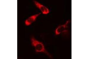 ABIN6277817 staining COLO205 cells by IF/ICC. (CARD11 抗体  (Internal Region))