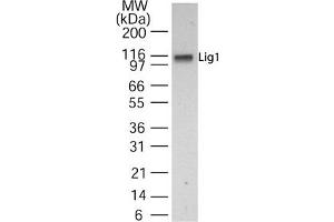Western Blotting (WB) image for anti-Ligase I, DNA, ATP-Dependent (LIG1) (AA 51-68) antibody (ABIN232932) (LIG1 抗体  (AA 51-68))