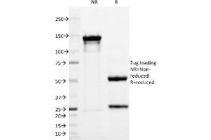 SDS-PAGE Analysis Purified PGP9. (UCHL1 抗体)