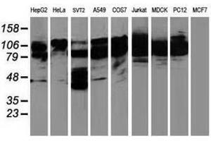 Image no. 3 for anti-Breast Cancer Anti-Estrogen Resistance 1 (BCAR1) antibody (ABIN1496834) (BCAR1 抗体)