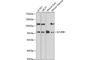 Western blot analysis of extracts of various cell lines, using IL12RB1 antibody (ABIN6132305, ABIN6142300, ABIN6142302 and ABIN6219020) at 1:1000 dilution. (IL12RB1 抗体  (AA 25-305))