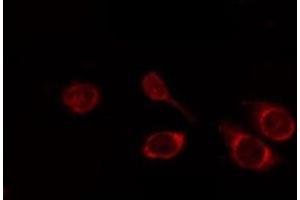ABIN6268769 staining HuvEc by IF/ICC. (CD147 抗体  (C-Term))