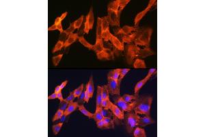Immunofluorescence analysis of C6 cells using JNK1/JNK3 Rabbit mAb (ABIN1678909, ABIN7101754, ABIN7101755 and ABIN7101756) at dilution of 1:100 (40x lens). (JNK 抗体)
