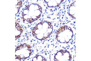 Immunohistochemistry of paraffin-embedded rat testis using Serotonin transporter Rabbit pAb (ABIN7270477) at dilution of 1:100 (40x lens). (SLC6A4 抗体  (C-Term))
