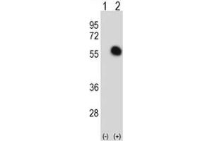 Western blot analysis of GATA2 antibody and 293 cell lysate either nontransfected (Lane 1) or transiently transfected (2) with the GATA2 gene. (GATA2 抗体  (AA 380-407))