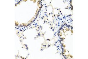 Immunohistochemistry of paraffin-embedded rat lung using IFNL1 antibody at dilution of 1:100 (40x lens). (IL29 抗体)