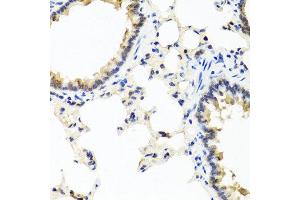 Immunohistochemistry of paraffin-embedded rat lung using IFNL1 antibody at dilution of 1:100 (40x lens).